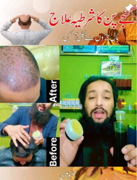 Instagram shop